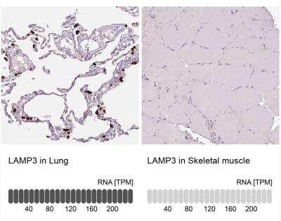 Immunohistochemistry-Paraffin: DC-LAMP Antibody [NBP2-33616]