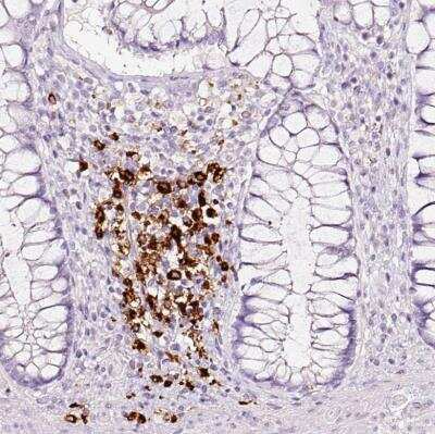 Immunohistochemistry-Paraffin: DC-LAMP Antibody [NBP2-33616]