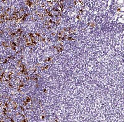 Immunohistochemistry-Paraffin: DC-LAMP Antibody [NBP2-33616]