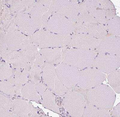 Immunohistochemistry-Paraffin: DC-LAMP Antibody [NBP2-33616]