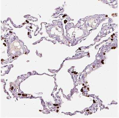 Immunohistochemistry-Paraffin: DC-LAMP Antibody [NBP2-33616]