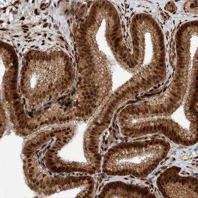 Immunohistochemistry: DC-SCRIPT/ZNF366 Antibody [NBP1-81921]