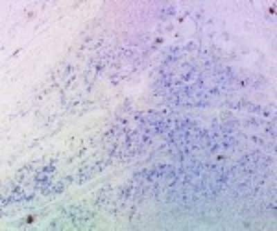 Immunohistochemistry: DC-SIGN/CD209 Antibody (102E11.06) [DDX0202P-100]