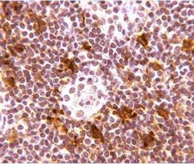 Immunohistochemistry-Paraffin: DC-SIGN/CD209 Antibody (109H12.03) [DDX0207]