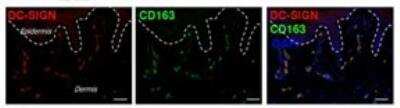 Immunohistochemistry: DC-SIGN/CD209 Antibody (111H2.02) [DDX0209]