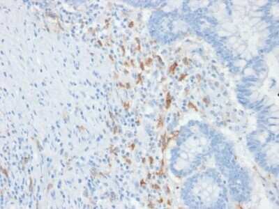 Immunohistochemistry-Paraffin: DC-SIGN/CD209 Antibody (C209/1781) - Azide and BSA Free [NBP2-54351]