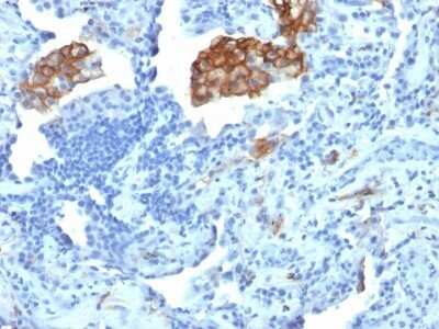 Immunohistochemistry-Paraffin: DC-SIGN/CD209 Antibody (C209/1781) - Azide and BSA Free [NBP2-54351]