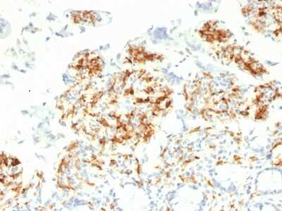 Immunohistochemistry-Paraffin: DC-SIGN/CD209 Antibody (C209/1781) - Azide and BSA Free [NBP2-54351]