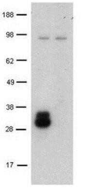 Western Blot: DC-SIGN/CD209 Antibody (LWC06)BSA Free [NBP1-43328]