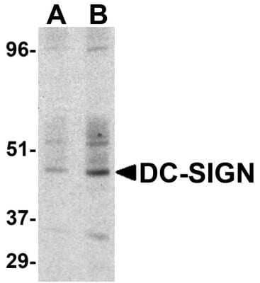 Western Blot: DC-SIGN/CD209 AntibodyBSA Free [NBP1-77284]