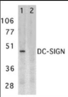 Western Blot: DC-SIGN/CD209 Antibody Blocking Peptide [NBP1-76787PEP]