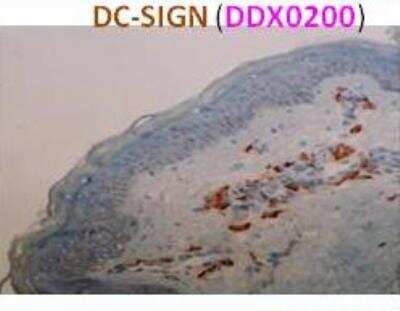 Immunohistochemistry-Paraffin: DC-SIGNR/CD299/CLEC4M Antibody (118A8.05) [DDX0200P-100]