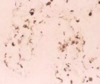 Immunohistochemistry: DC-SIGNR/CD299/CLEC4M Antibody (128G8) [DDX0201P-100]