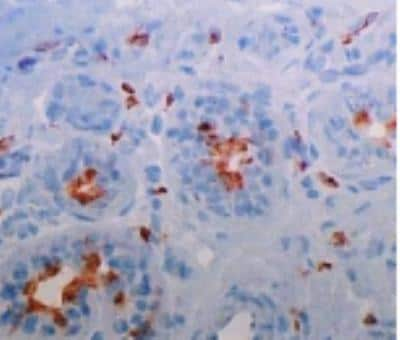 Immunohistochemistry: DC-SIGNR/CD299/CLEC4M Antibody (128G8) [DDX0201P-100]