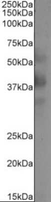 Western Blot: DC-SIGNR/CD299/CLEC4M Antibody (16E7)ChimericAzide and BSA Free [NBP2-52649]