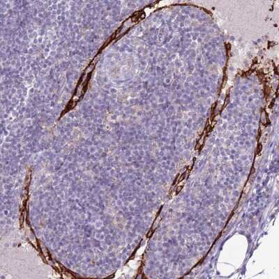 Immunohistochemistry-Paraffin: DC-SIGNR/CD299/CLEC4M Antibody [NBP2-48770]