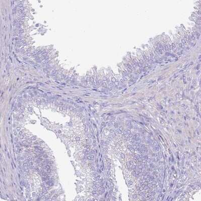 Immunohistochemistry-Paraffin: DC-SIGNR/CD299/CLEC4M Antibody [NBP2-48770]