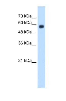 Western Blot: DC-SIGNR/CD299/CLEC4M Antibody [NBP1-59182]