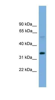 Western Blot: DC-STAMP/TM7SF4 Antibody [NBP1-79329]