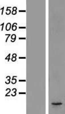 Western Blot: DC2 Overexpression Lysate [NBL1-09736]