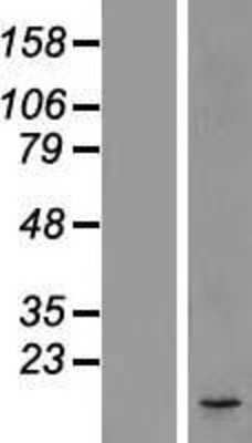 Western Blot: DC2 Overexpression Lysate [NBL1-09736]