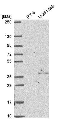 Western Blot: DC8 Antibody [NBP2-58614]