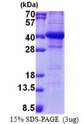 SDS-PAGE: Recombinant Human DC8 His Protein [NBP2-23295]