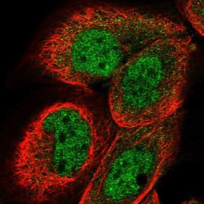 DCAF11 Antibody (NBP1-83364) | Bio-Techne