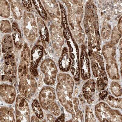 Immunohistochemistry-Paraffin: DCAF11 Antibody [NBP1-83364]