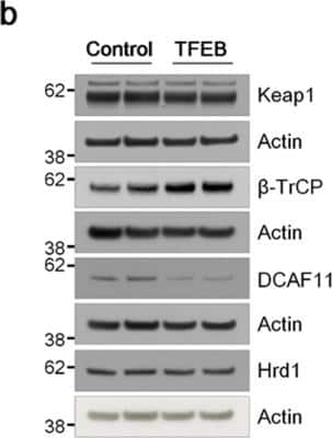 Western Blot: DCAF11 Antibody [NBP1-57691]