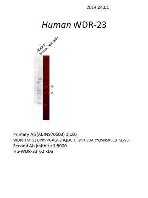 Western Blot: DCAF11 Antibody [NBP1-83364]