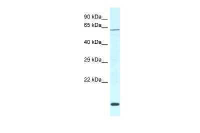 Western Blot: DCAF11 Antibody [NBP2-87249]