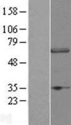 Western Blot: DCAF11 Overexpression Lysate [NBL1-17798]