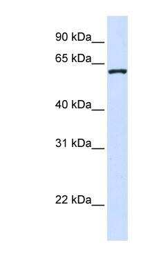 Western Blot: DCAF12 Antibody [NBP1-56584]