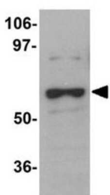 Western Blot: DCAF12 AntibodyBSA Free [NBP1-77373]