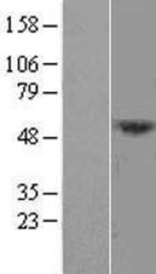 Western Blot: DCAF12L1 Overexpression Lysate [NBL1-17806]