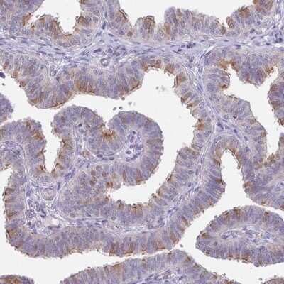 Immunohistochemistry: DCAF12L2 Antibody [NBP2-33676]