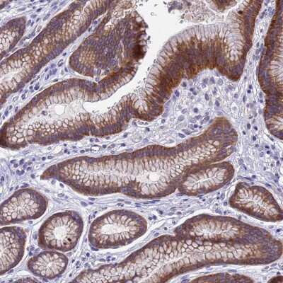 Immunohistochemistry-Paraffin: DCAF12L2 Antibody [NBP2-33428]