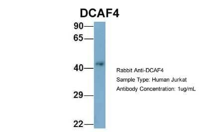 Western Blot: DCAF4 Antibody [NBP1-52862]