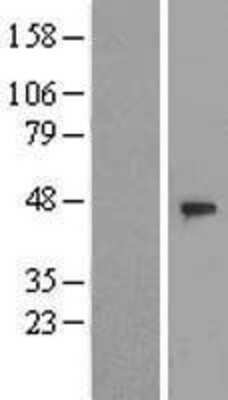 Western Blot: DCAF4 Overexpression Lysate [NBL1-17796]