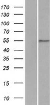 Western Blot: DCAF4 Overexpression Lysate [NBP2-07144]