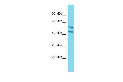 Western Blot: DCAF4L2 Antibody [NBP2-82822]