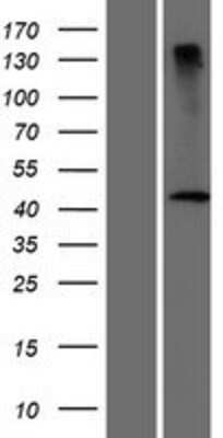 Western Blot: DCAF4L2 Overexpression Lysate [NBP2-05371]