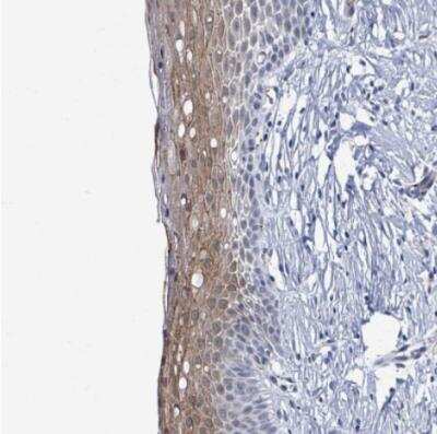 Immunohistochemistry-Paraffin: DCAF5 Antibody [NBP2-30396]