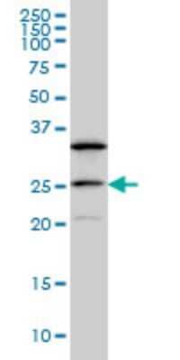 Western Blot: DCAKD Antibody (3E4) [H00079877-M02]