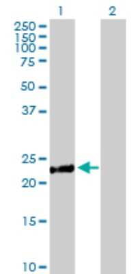 Western Blot: DCAKD Antibody [H00079877-B01P]