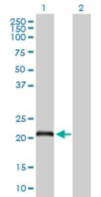 Western Blot: DCAKD Antibody [H00079877-D01P]