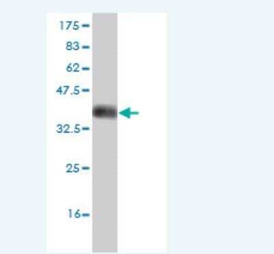 Western Blot: DCAMKL2 Antibody (2A5) [H00166614-M01]