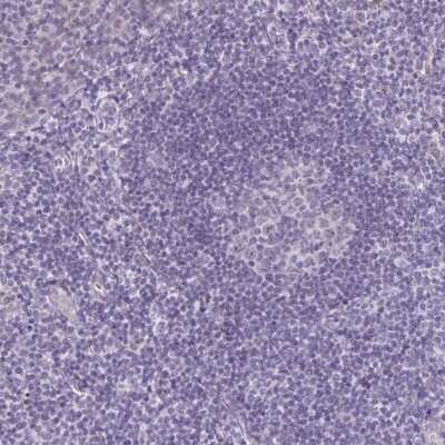 Immunohistochemistry-Paraffin: DCAMKL2 Antibody [NBP1-85282]