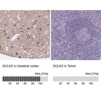 Immunohistochemistry-Paraffin: DCAMKL2 Antibody [NBP1-85282]